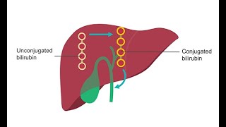 Analyzing liver function–How to use lab values [upl. by Hsirk]