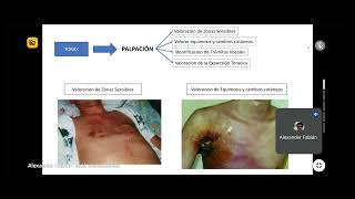 INSPECCIÓN II Y PALPACIÓN I  SEMIOLOGÍA DEL SISTEMA RESPIRATORIO [upl. by Hgielanna]