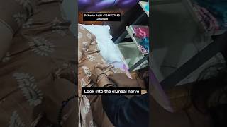 Needle the cluneal nerve to relieve the lower back pain 💥 lowerbackpain trending ytshorts [upl. by Petulah248]