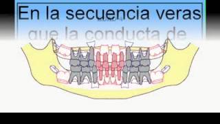 MUELA DEL JUICIO [upl. by Barton]