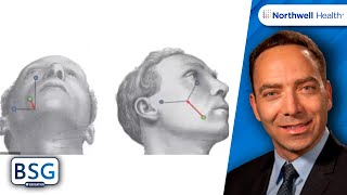 Type I and Type II Trigeminal Neuralgia [upl. by Smoot593]