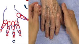 Therapeutische handmassage [upl. by Amati]