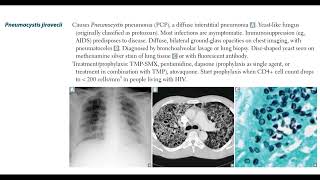 Opportunistic fungal infections Mucor Pneumocystis jirovecii Sporothhrix schenckii6 [upl. by Aletta]