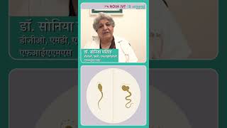 Semen Analysis  Dr Sonia Malik  Nova IVF Vasant Vihar  Delhi NCR [upl. by Evangelia]