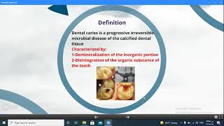 lecture 1 at chapter Dental caries with Dr omnya wahba اول محاضرة في شابتر ال dental Caries [upl. by Annunciata650]