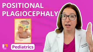 Positional Plagiocephaly Musculoskeletal Disorders  Pediatric Nursing  LevelUpRN [upl. by Attenrev]