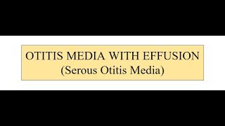 OTITIS MEDIA WITH EFFUSION [upl. by Addiel]