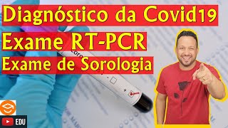 Teste Covid  Diferenças entre os exames RTPCR e de Sorologia IgM e IgG [upl. by Rogers]