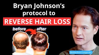 Bryan Johnson’s protocol to reverse hair loss [upl. by Dorin]