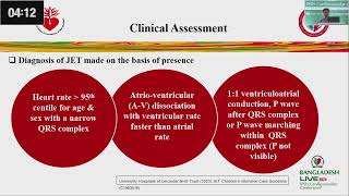 Ivabradine  A Game Changer for Post Surgical Junctional Ectopic Tachycardia by Dr Md Abu Talha [upl. by Hinch]