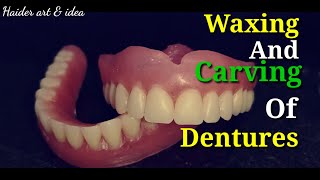 Wax up of complete dentures  Waxing and carving of Complete dentures  How to waxing amp carving [upl. by Regor269]