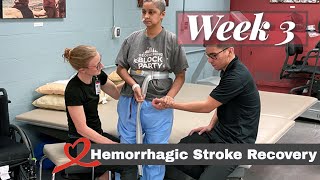 Hemorrhagic Stroke Recovery  Week 3 [upl. by Angrist679]