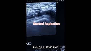 Knee joint ultrasound Guided effusion Aspiration [upl. by Percy]