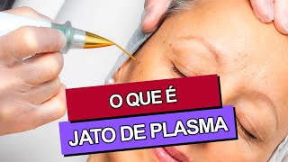 JATO DE PLASMA Antes e Depois [upl. by Hu]