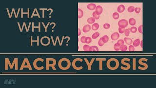 Macrocytosis  WHAT is it WHY is it Causes HOW to investigate  RAPID OVERVIEW OF MACROCYTOSIS [upl. by Cartwell]