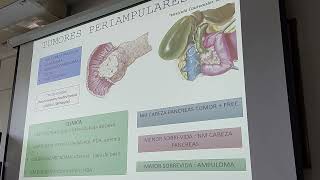 TEORÍA 14 NEOPLASIAS PANCREÁTICAS [upl. by Perdita]