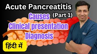 Acute Pancreatitis एक गंभीर बीमारी Acute Pancreatitis in hindi [upl. by Lenahs]