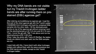 Gel electrophoresis faint bands [upl. by Etom]