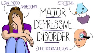 Depression Explained Major Depressive Disorder [upl. by Gerius]