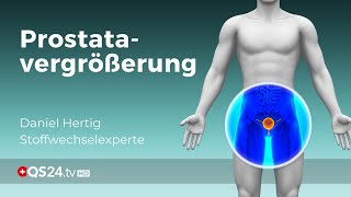 Wie schlimm ist eine ProstataVergrösserung  Alternativmedizin  QS24 Gesundheitsfernsehen [upl. by Ahsino]