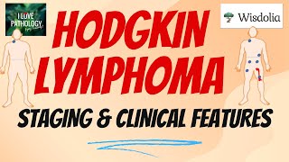 HODGKIN LYMPHOMA  Staging Clinical Features  Treatment Prognosis [upl. by Ajiat564]