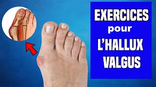 HALLUX VALGUS  TRAITEMENT ET EXERCICES KINÉ [upl. by Annayehc]