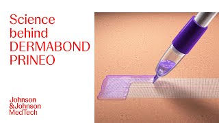 Science Behind Stronger Closure Using DERMABOND PRINEO Skin Closure System  JampJ MedTech [upl. by Ahsinet]