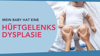 Mein Baby hat eine Hüftgelenksdysplasie Übungen zur Reifungsförderung der Hüftgelenke [upl. by Sirromal]