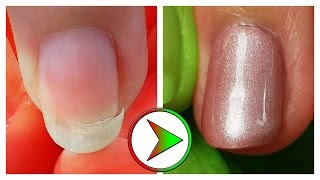 extrem eingebrochenen Nagel retten  Tutorial Nagelreparatur amp Reinigung [upl. by Airan]