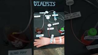 Haemodialysis working model made by our group shorts shortsfeed [upl. by Byran]