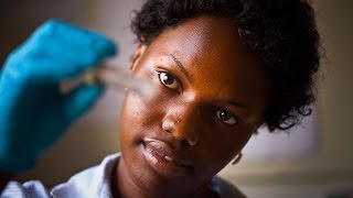 Making it Happen The Science Behind Eliminating River Blindness [upl. by Lemaj804]