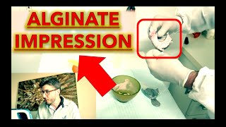 Alginate Impression Tips for Beginners Step by Step Dental Tutorial Study Casts Prosthodontics [upl. by Aix728]