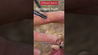 REMOVAL OF WICKED SPLINTER 😳shorts splinter [upl. by Otho]