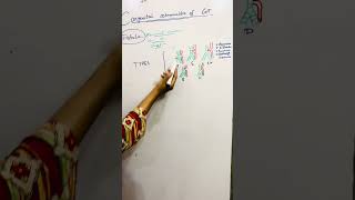 Tracheoesophageal fistulas  Types of tracheoesophageal fistulasmedicostuff [upl. by Karly]