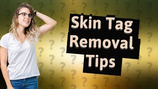 How to make a skin tag fall off [upl. by Lrub449]