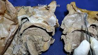 Nasal cavity and paranasal air sinuses [upl. by Eitsyrc264]