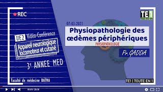 PHYSIOPATHOLOGIE  Physiopathologie des œdèmes périphériques [upl. by Maynord]