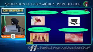 Dr MECID SOUHILA Endocardite infectieuse [upl. by Aretta]