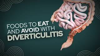 Foods To Eat and Avoid With Diverticulitis [upl. by Rolland466]