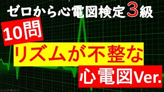 問題集⑤【リズムがバラバラな心電図】ゼロから心電図検定４級、3級 [upl. by Salakcin]