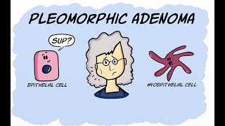 Pleomorphic Adenoma [upl. by Vihs]