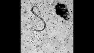 The immune system in action how white blood cells attack a parasitic worm [upl. by Ciapas]