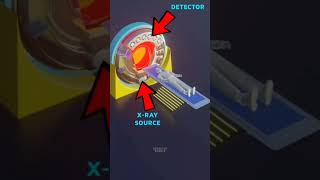 How CT scan machine works ctscan xray machine [upl. by Enneiviv]