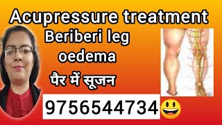 Beriberi Acupressure treatment Oedema शोफ बेरीबेरी swelling सूजन beriberi oedema swelling painful [upl. by Lay]