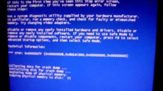 Windows Vista Instant BSOD 7F When Unplugging Dazzle Capture Card [upl. by Hannahc]