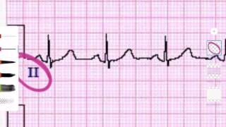 ECG  Derivaciones y caras  1 Ciclo cardiaco básico [upl. by Euton238]