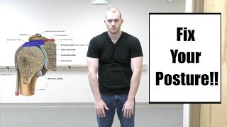 Shoulder Impingement Syndrome  Exercises for Shoulder Pain [upl. by Anilehs]