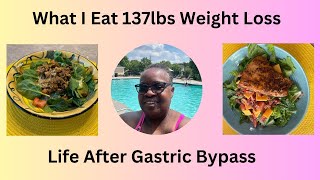 WHAT I EAT AFTER GASTRIC BYPASS I LOST 137 POUNDS [upl. by Bullivant408]