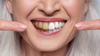 11 Natural Ways to Whiten Teeth at Any Age [upl. by Finlay]