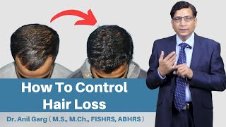 Hair Loss Control Clinic can Help You Grow Hair Naturally  FDA Approved [upl. by Epifano731]